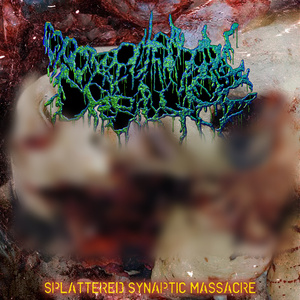 Hemicranial Gush Parade