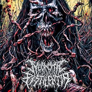 Cerebral Atrophy