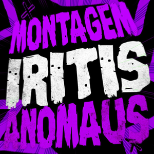 Montagem Iritis Anomaus