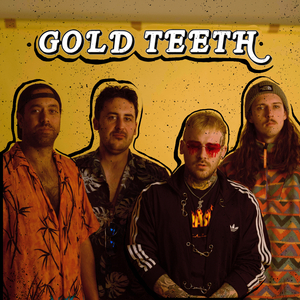 GOLD TEETH