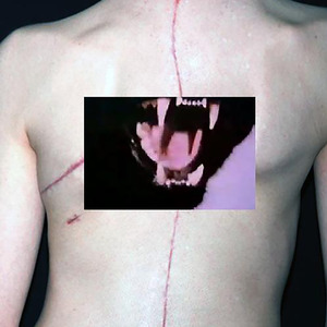 Intensive Therapy Session Number Four