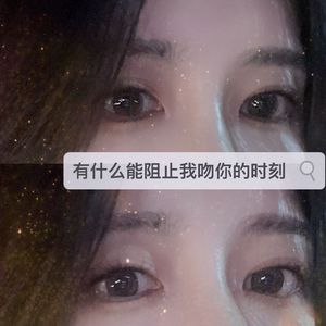 彗星