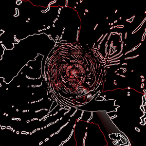 В. Т. Ч. С интро (Surematus)