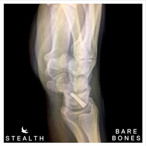 How Much Further (Acoustic)