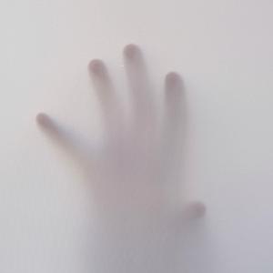 Psychosis