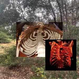 Ribcage