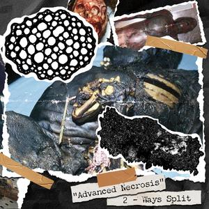 Intestinal Excretion