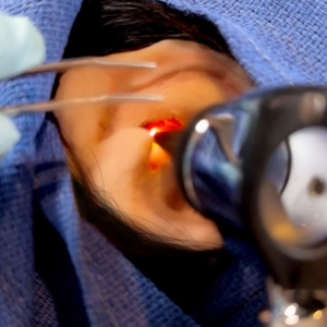 Otoscope