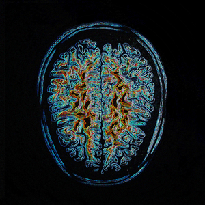 Brainwave