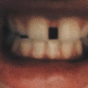 CALL ME UP (**** ME UP)