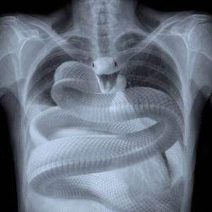 病（Prod by Young oz）