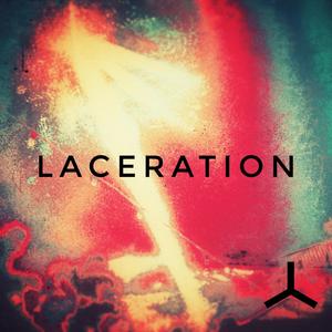 Laceration
