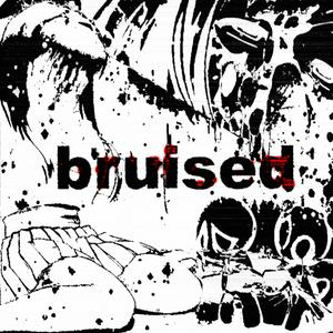 bruises