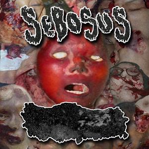 Nasal Cerebrospinal Fluid Leak