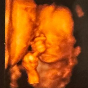 我们即将在冬季见面