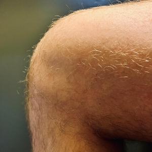 Knee (24.01.05.11.22.)