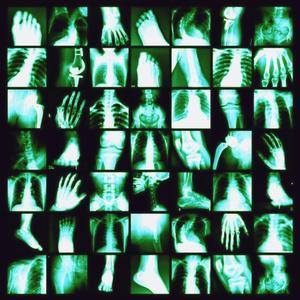 DARK CLOUDS (Treason) (feat. Chopski)