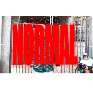 Normal
