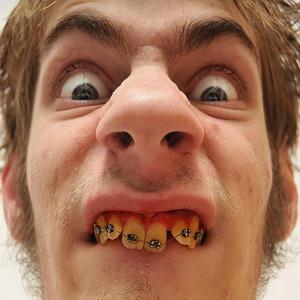 Harry hou je kanis! | Grappige liedjes!