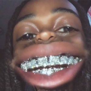 【Free】阿姨卑斯