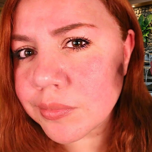 Limpieza Profunda y Raspado Cuidadoso de la Piel