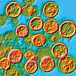 Hantavirus