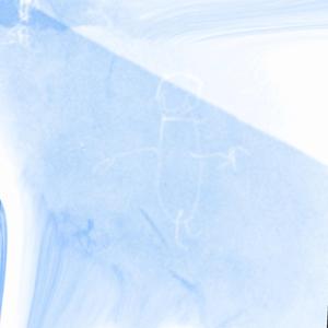 my best friend (user remix)