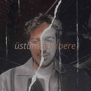 üstümdeki bere