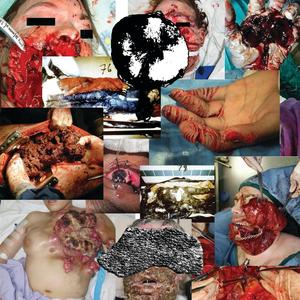 10 SONGS ABOUT THAT ONE TIME KRATOM GAVE ME AUDITORY HALLUCINATIONS