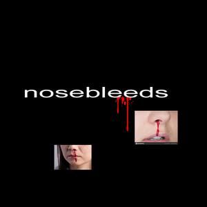 nosebleeds