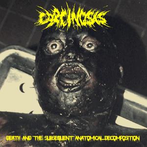 Self Extirpation Of a Genital Teratoma