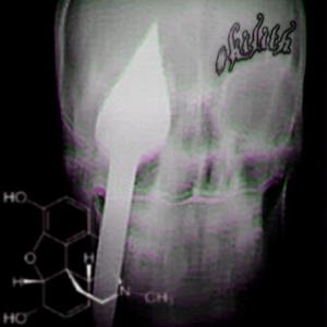 cryonics (feat. iso2cold)