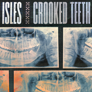 Crooked Teeth