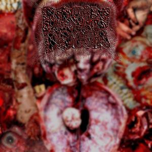 Cerebrospinal Fluid Leak