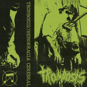 Malfuncionamiento Cerebral