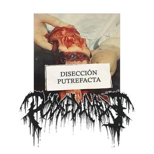 Gripa En La Entrepierna