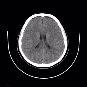 离心力(cover.唐汉霄)