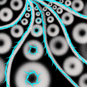 Chapter 1. Intruded Brain