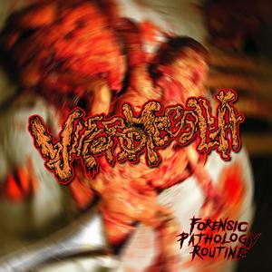 PERFORACIÓN TRAUMÁTICA DE LA AORTA TORÁCICA (HEMOTÓRAX SEVERO)