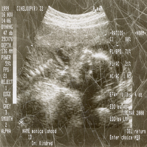 dysphagia