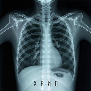 Хрип