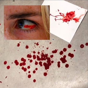 Интерлюдия