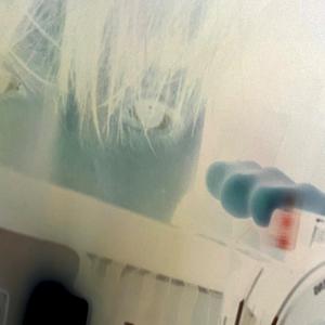 כואב לי הראש (feat. JohnnyT)