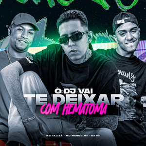 O Dj Vai Te Deixar Com Hematoma