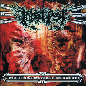 Chronic Inflammatory Demyelinating Polyneuropathy