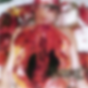 The Vile Sores in Urticariothrocisism Goulashed Decrepitance