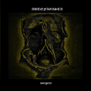 Antithrombotic Therapy for Prophylaxis and Treatment of Venous Thromboembolism in Patients with Cancer