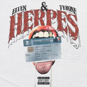 Herpes