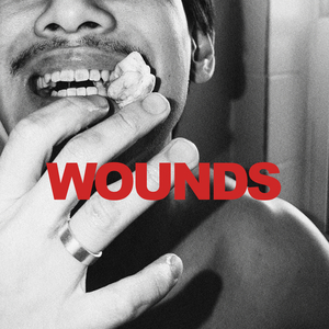 Wounds