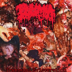 Transanal Evisceration